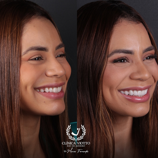 Dentista de Celebridades em São Paulo Dr. Viotto