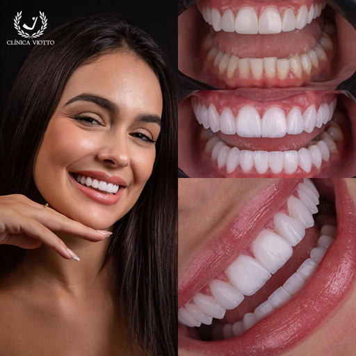 Estética do Sorriso Viotto Moderna