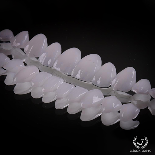 Facetas de Porcelana Viotto Especializadas