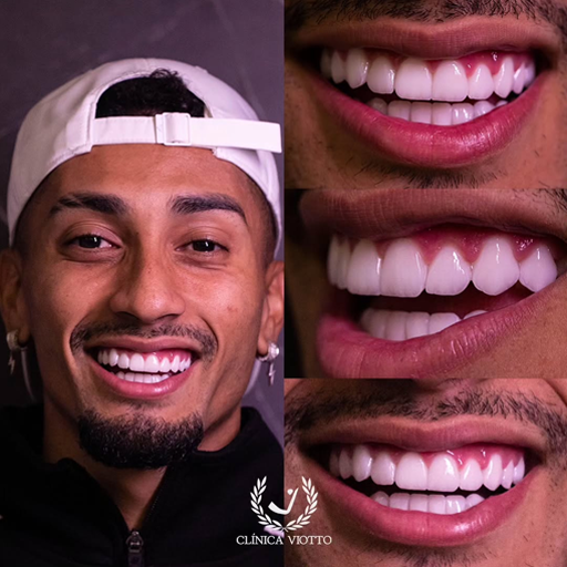 Sorriso Perfeito Natural e Harmonioso com Dr. Viotto