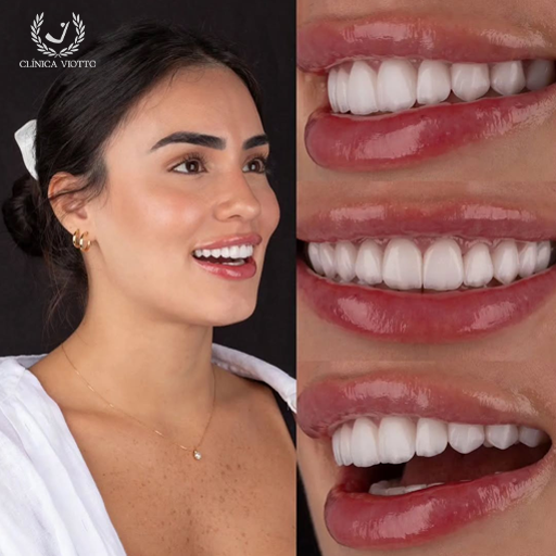 Sorriso Perfeito Natural